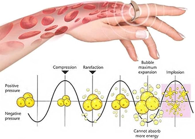 Blood Sugar Control Magnetic Ring